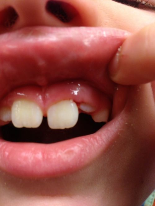 teeth mouth dental
