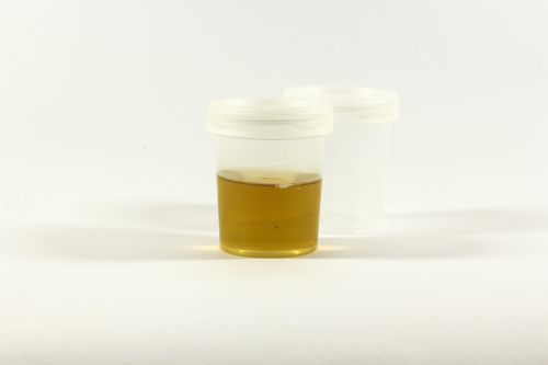 the test urine container urine