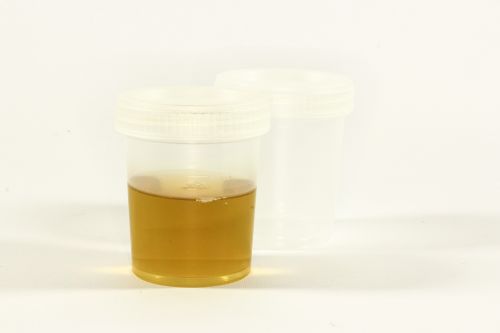 the test urine container urine