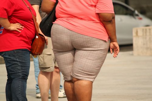 thick overweight obesity