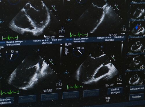ultrasound x ray image hospital