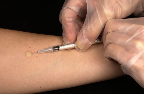 vaccination tuberculin test syringe