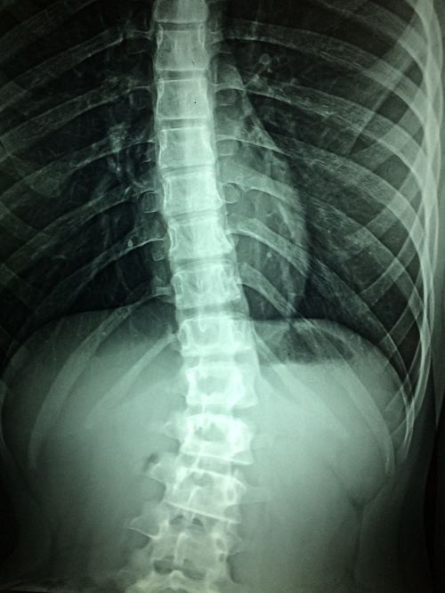 x-rays hospital disability